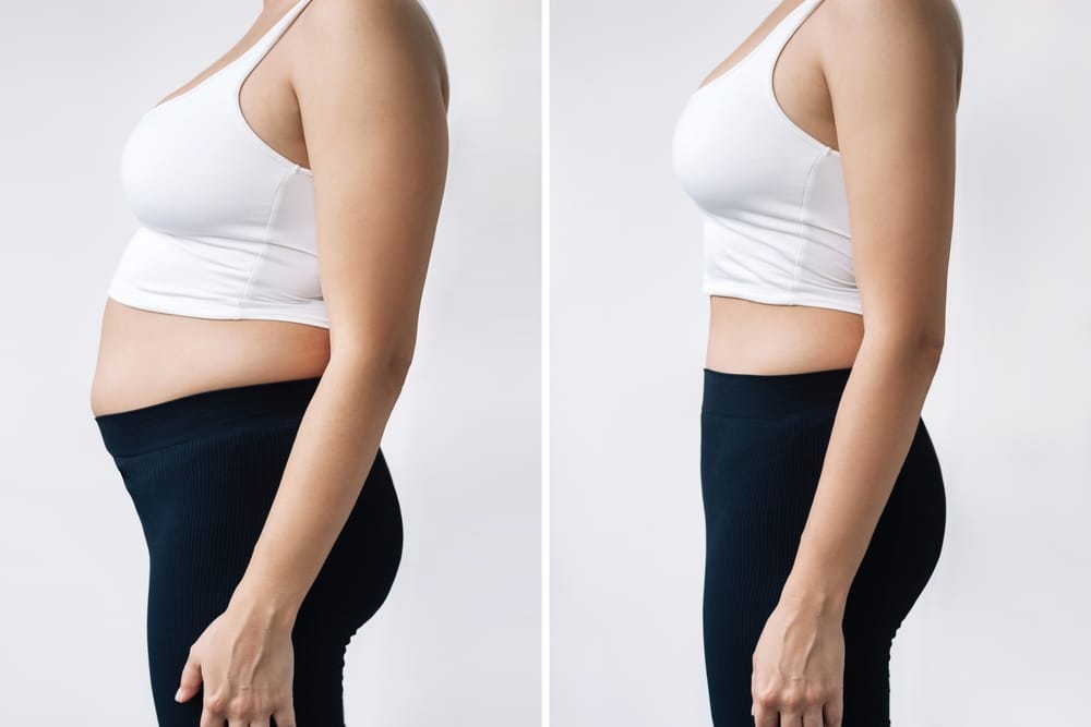Fat reduction treatments