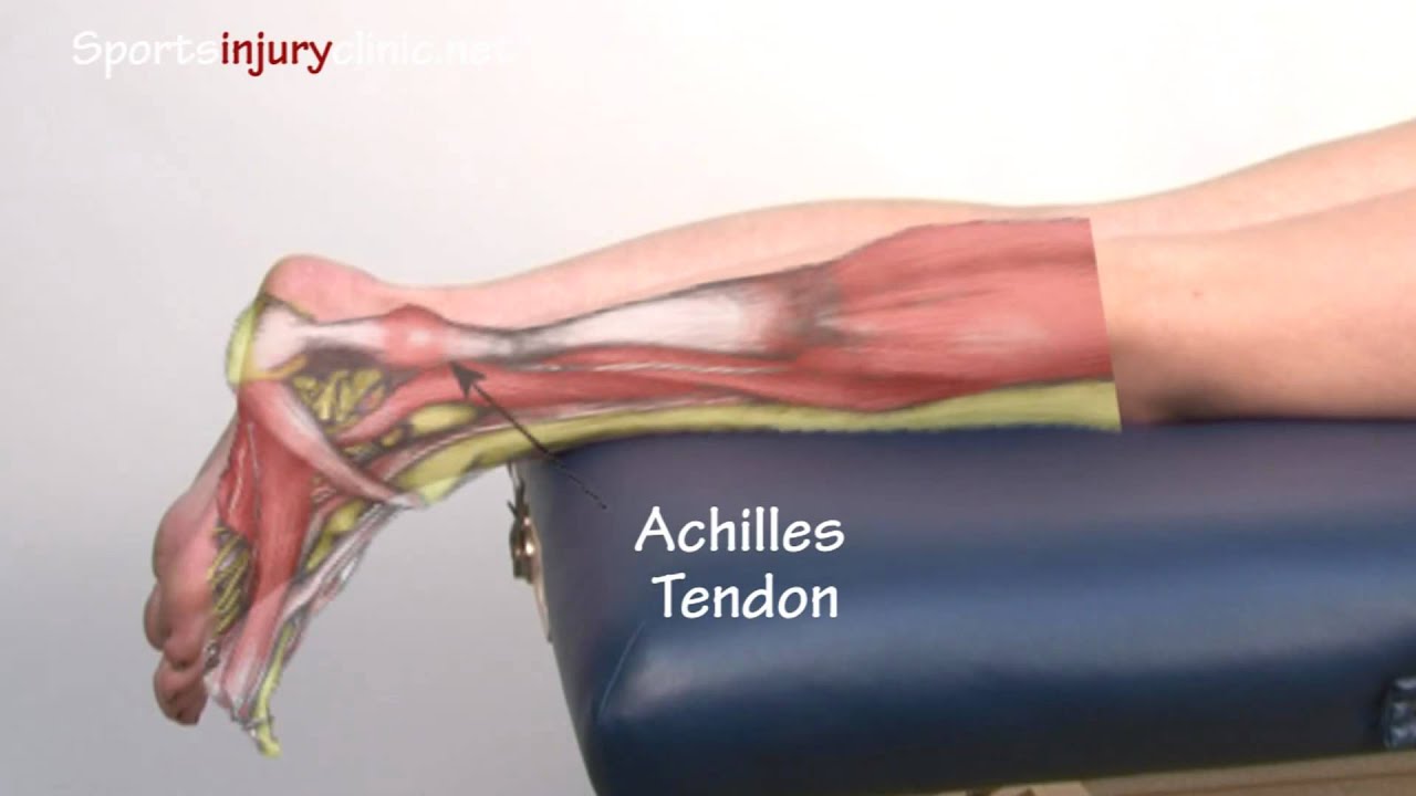 Rehabilitate Achilles Tendinopathy with Experts in Edinburgh UK