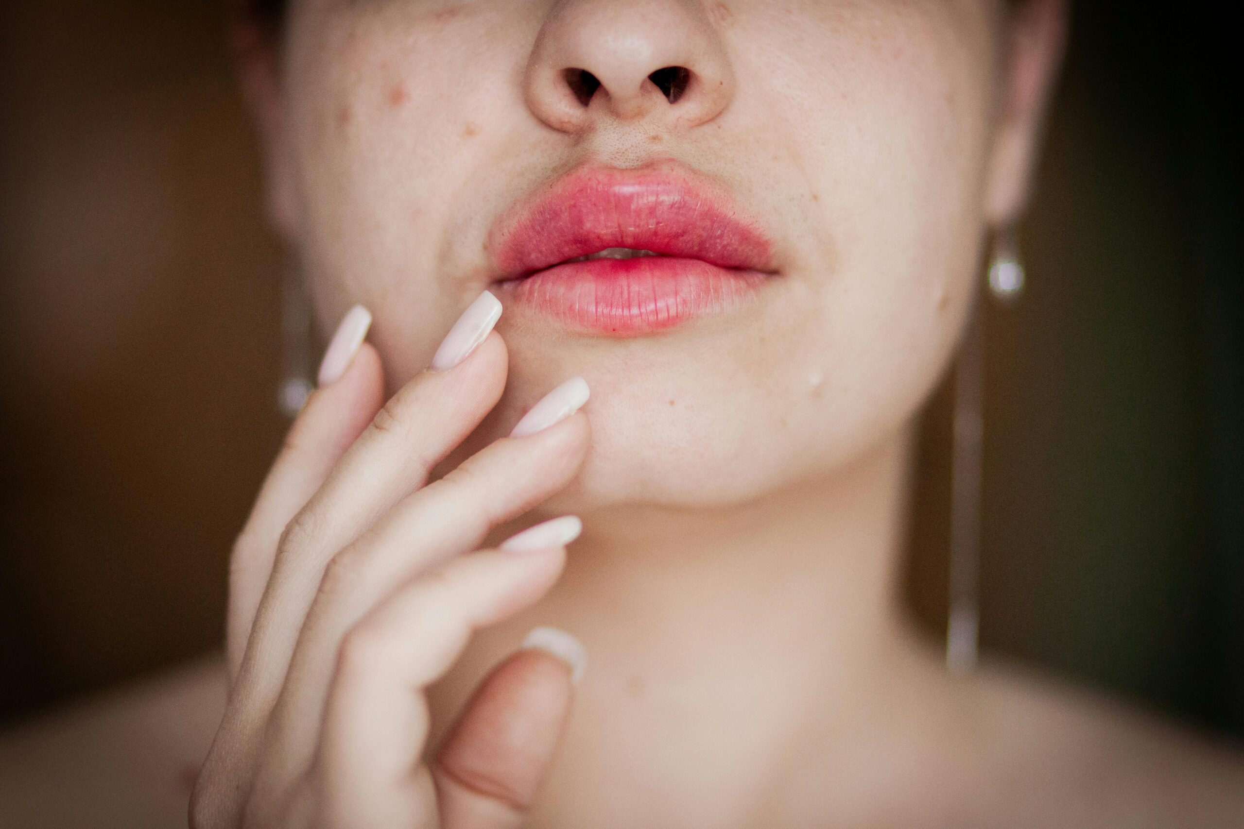 Lip Treatment for Dry Lips