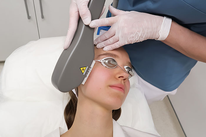 IPL skin treatment device targeting facial pigmentation and redness in clinical aesthetic procedure