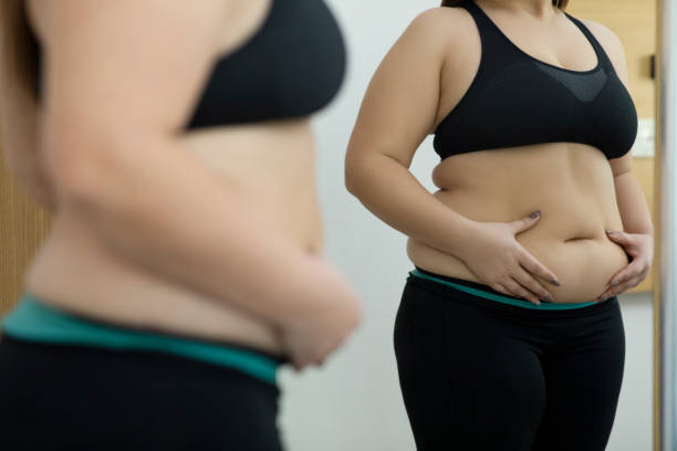 Liposuction surgery in Dubai