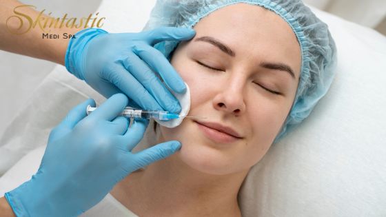 Lip Fillers Riverside